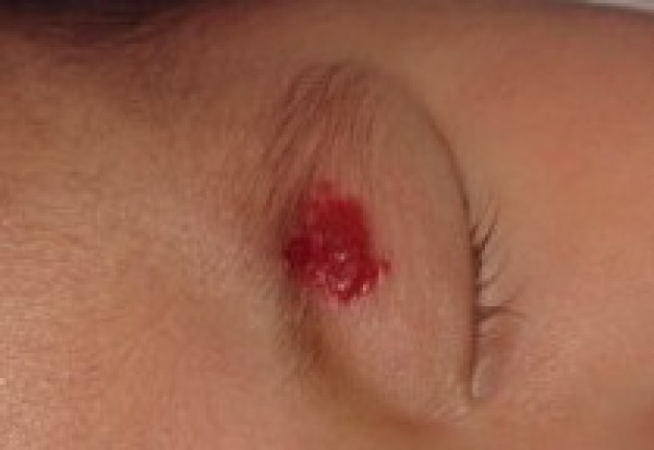 点击查看源网页