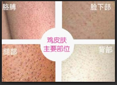 点击查看源网页