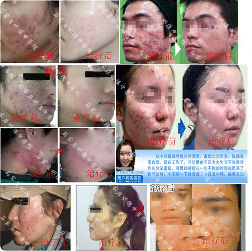 石家庄明德中医院皮肤科
