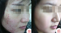 石家庄明德中医院皮肤科