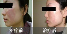 大学生都市寻梦，工作未定却遭皮炎侵袭